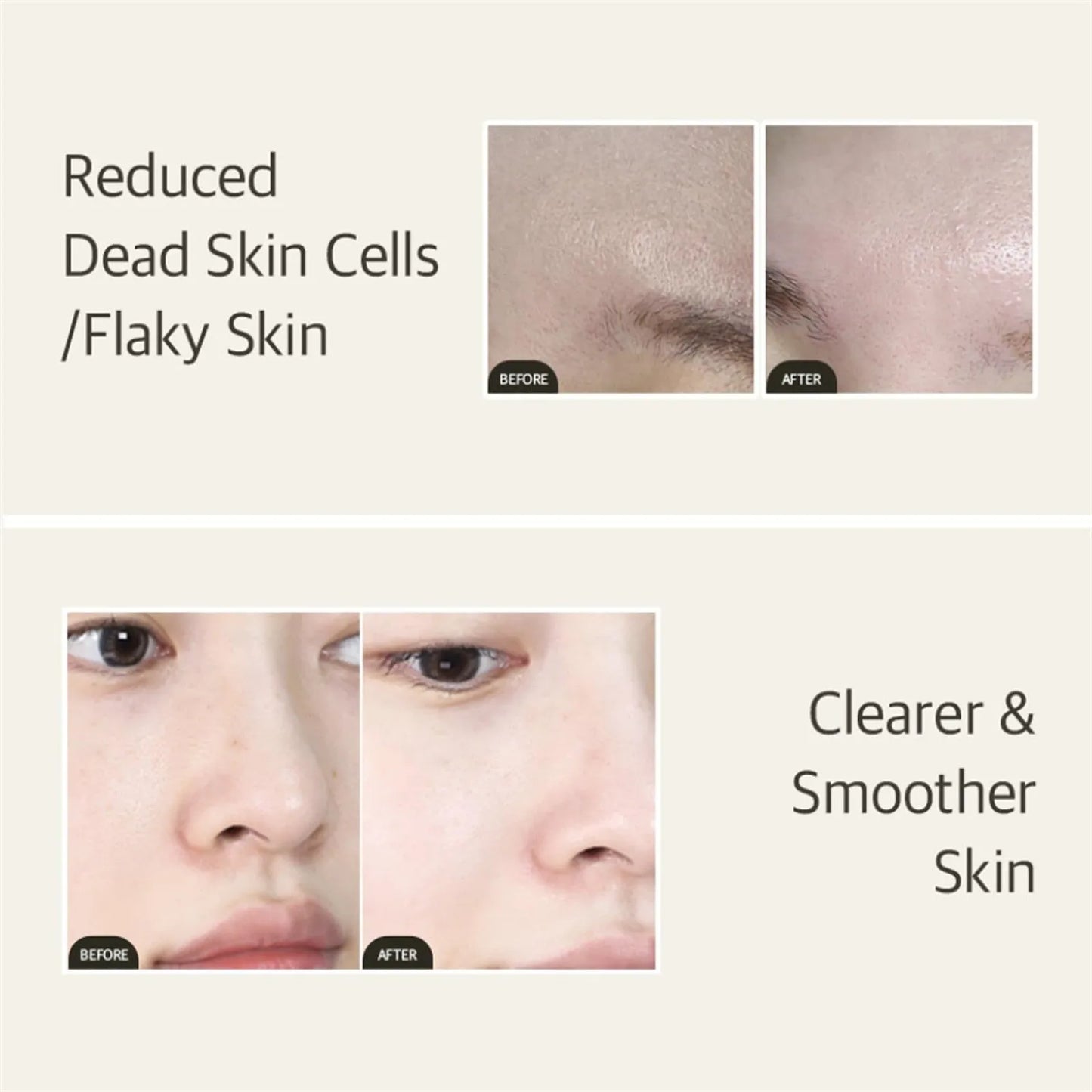 Mixsoon's Vegansnail Glassskin Absorb Facial Impurities To Remove Acne And Smooth The Skin 1.69 Fl Oz / 50ml