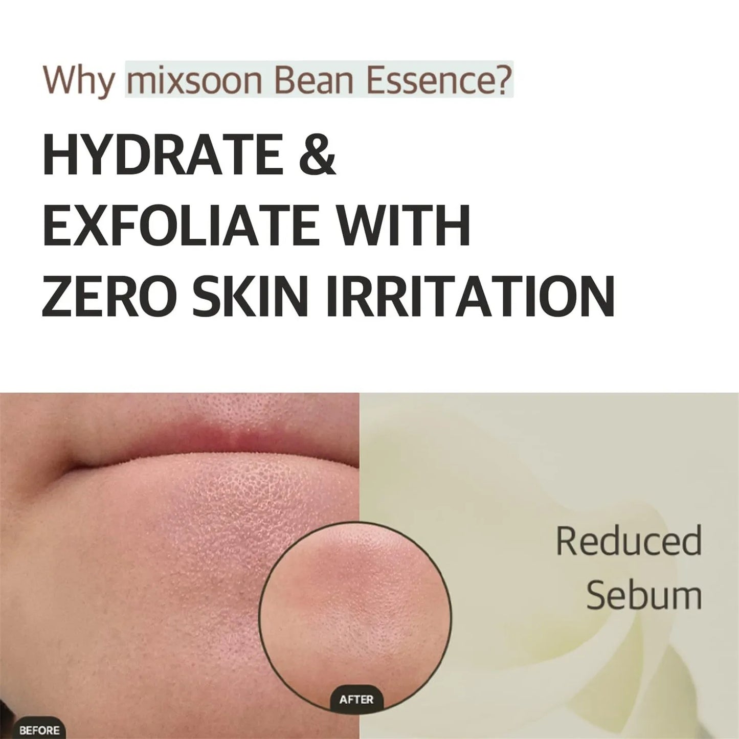 Mixsoon's Vegansnail Glassskin Absorb Facial Impurities To Remove Acne And Smooth The Skin 1.69 Fl Oz / 50ml